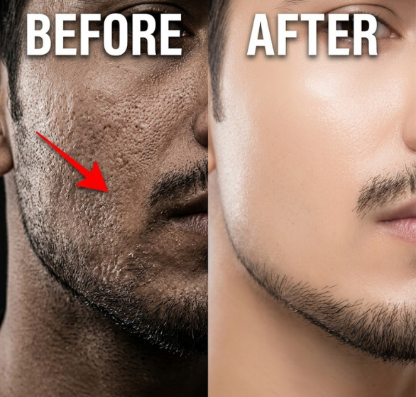 Red Carpet Peel